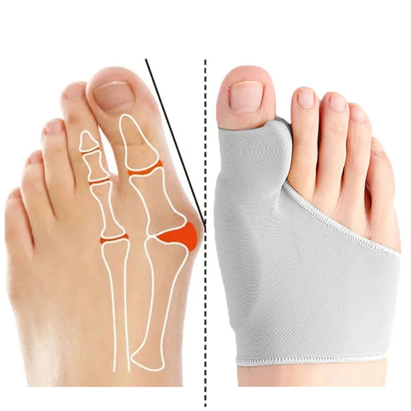 Corretor de Joanete – Separador de Dedos Joanetex - HP OnlineShop